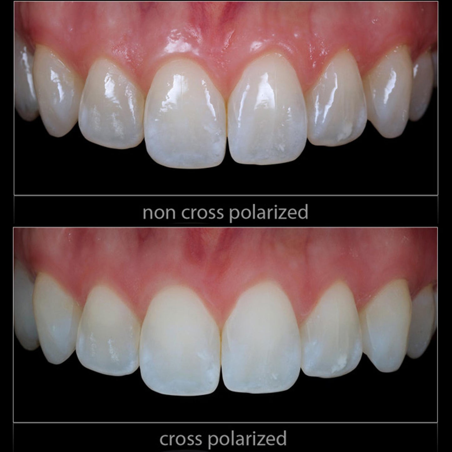 Cross Polarization Set For YONGNUO YN-24EX