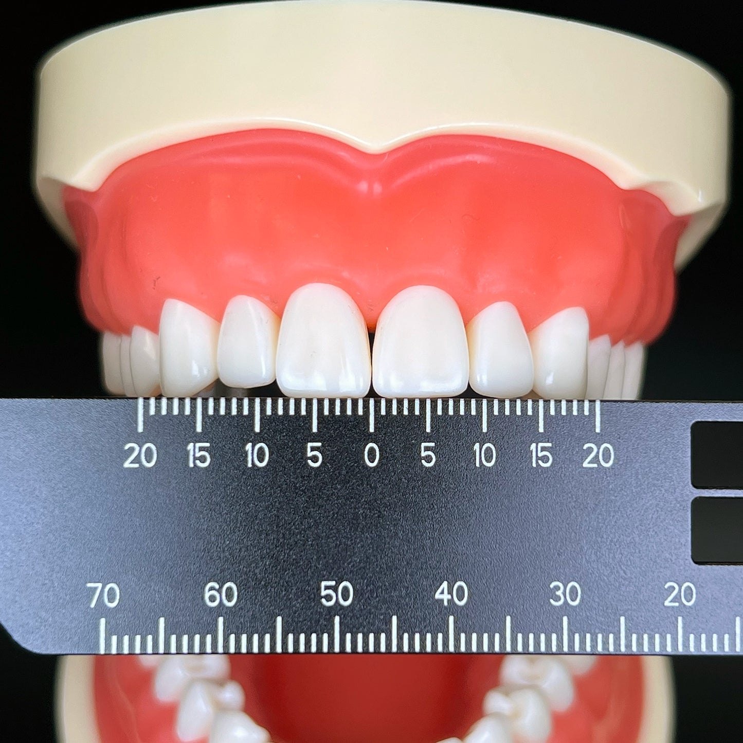 歯科精密測定定規写真撮影および歯科用医療ツール